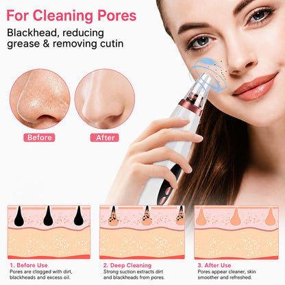 6-in-1 USB Rechargeable Blackhead Remover with 3 Suction Levels